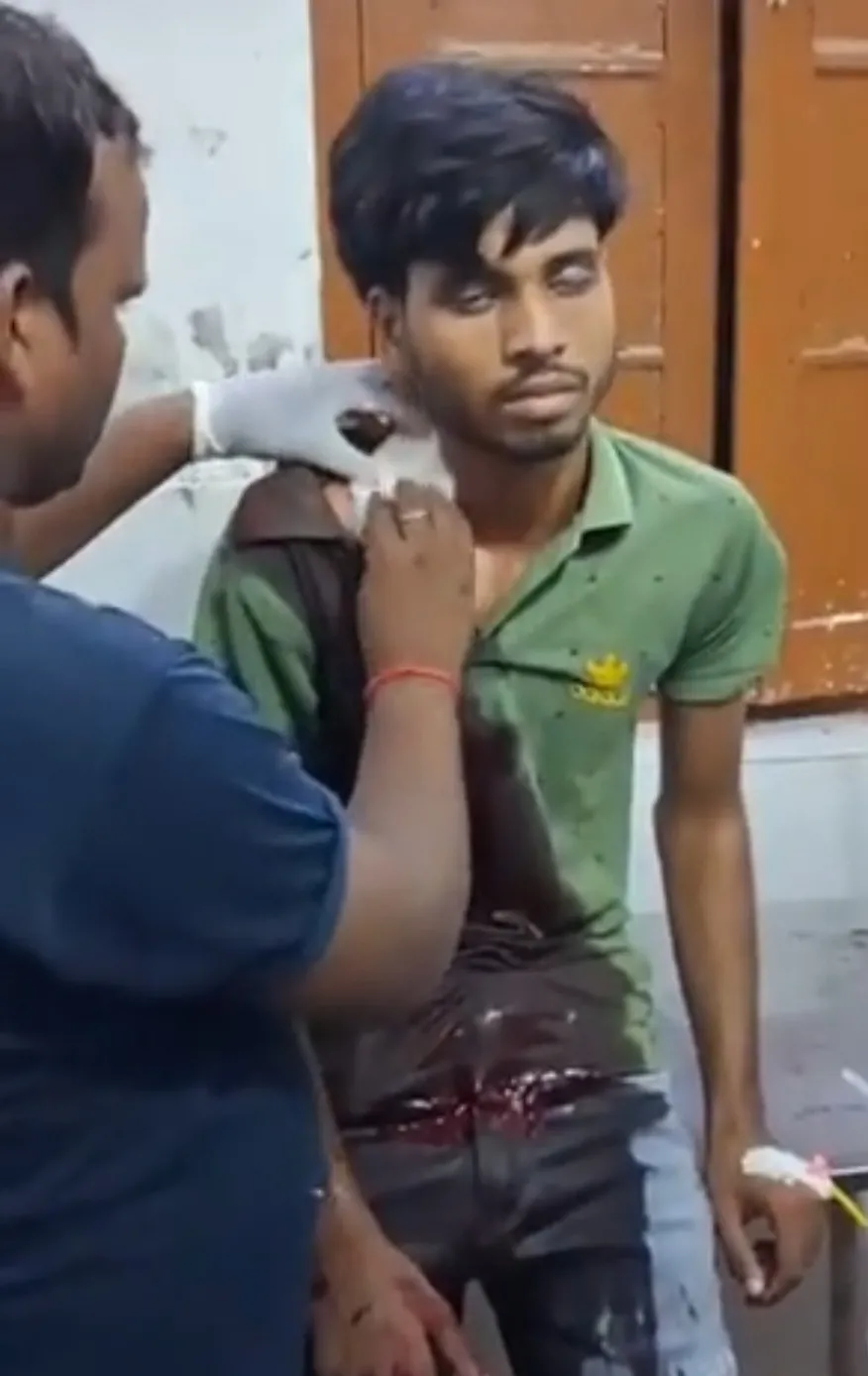 *चाकू के हमले से किशोर  बुरी तरह हुआ घायल*
