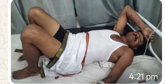 मवेशियों के लिए चारा काटने गए किसान पर गिरी आकाशी बिजली, गंभीर रूप से झुलसा