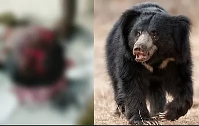 Kudligi | Bear attack while
working in the field: Farmer seriously injured
Kudligi (Vijayanagar): A bear attacked a far