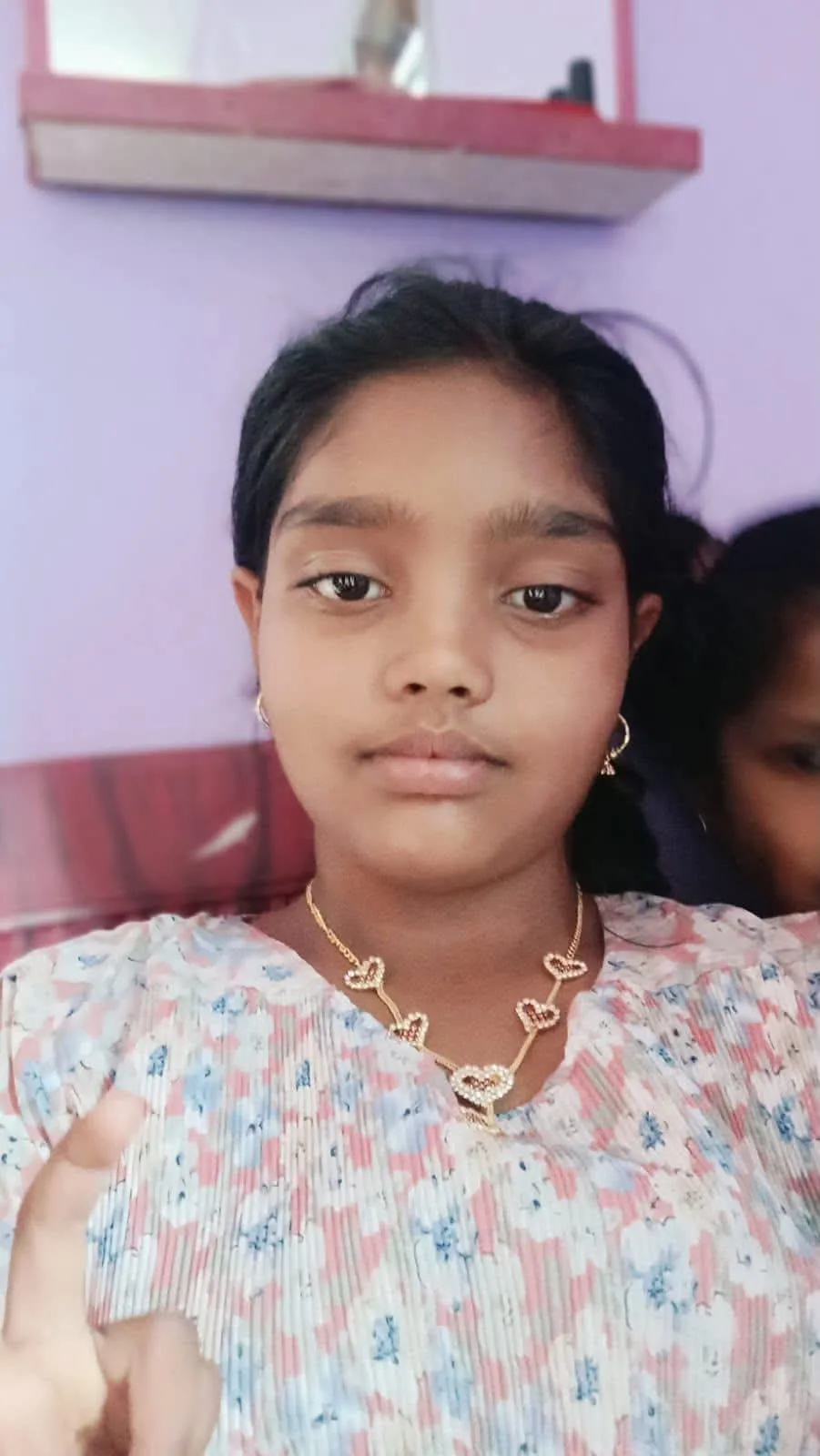 Shivamogga: 12-year-old student of Ragigudda Residential School Shweta dies