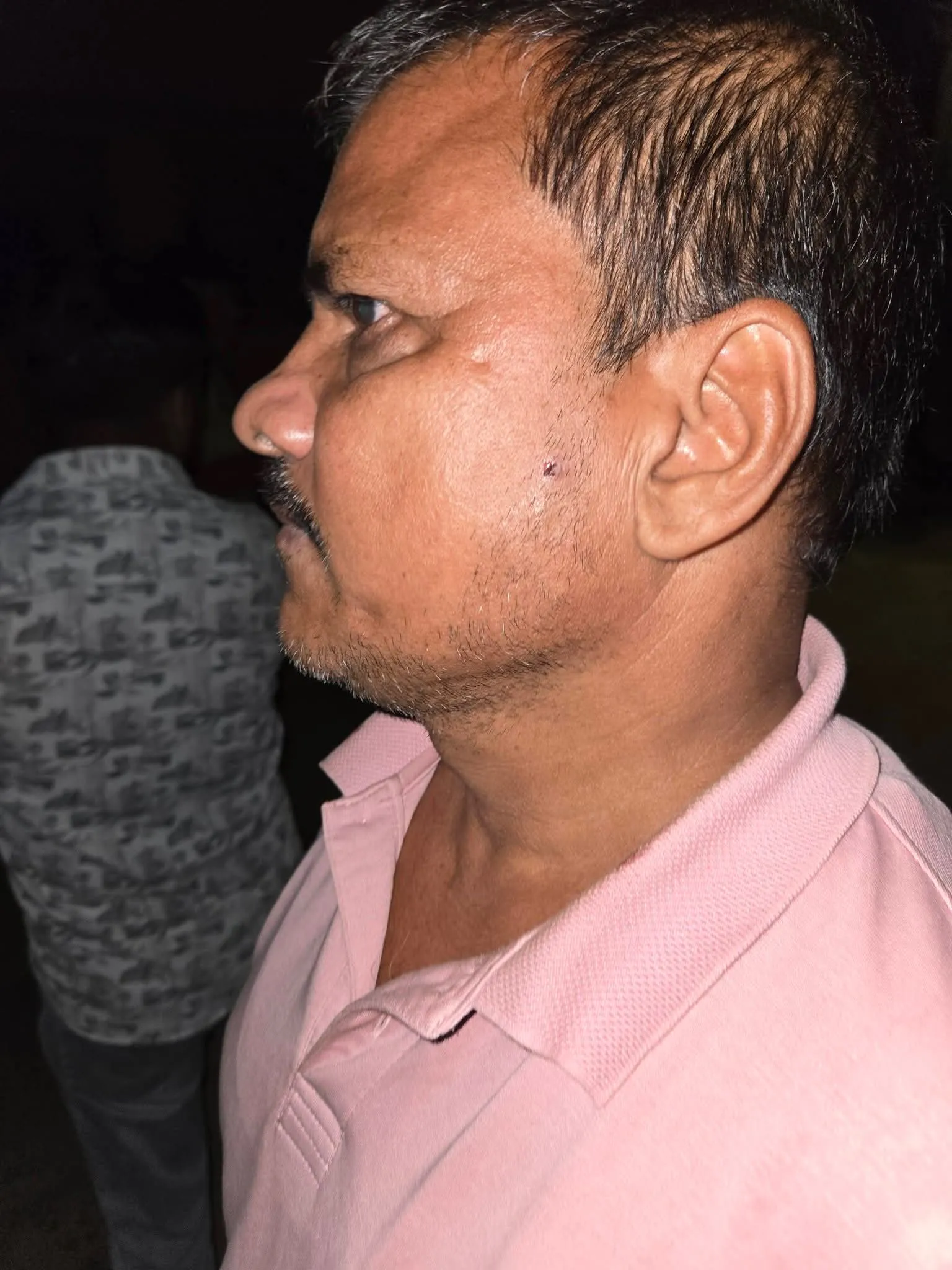हिसुआ में दुकान बंद कर घर लौट रहे दुकानदार पर गोली से जानलेवा हमला