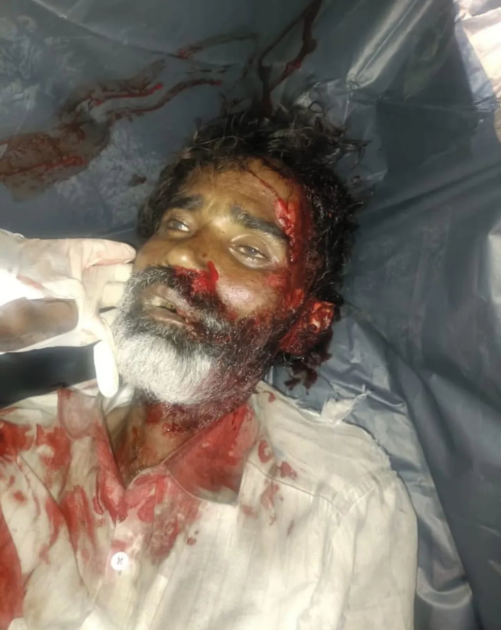గుర్తుతెలియని వ్యక్తి- ఆర్టీసీ ప్రైవేట్ బస్సు ఢీకొని మృతి